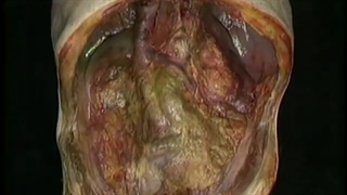 کلیه‌ها آکلند دوبله فارسی