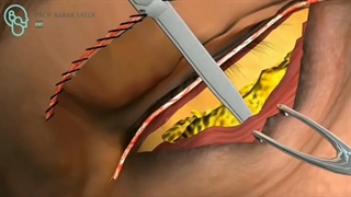 با چروک چشمت خداحافظی کن