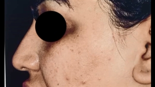 فیلم واقعی جراحی بینی