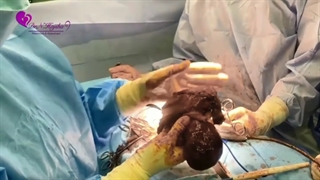 جراحی بخاطر فیبروم بزرگ !!