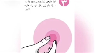 سرطان سینه در کمینته