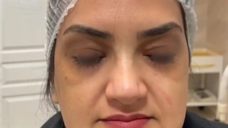 جوانسازی توی یک جلسه