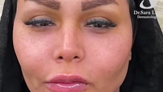 تغییراتش چطور شده؟