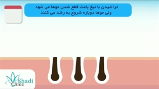 وکس، ژیلت یا لیزر ⁉️