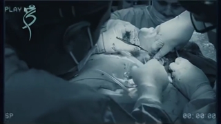 با این جراحی میدونی چند سال جوانتر میشی؟