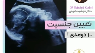 تعیین جنسیت صد۱۰۰درصدی داریم؟! 