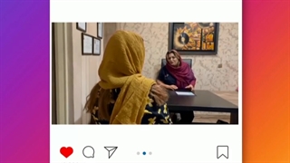ده روز بعد از لابیاپلاستی و تزریق چربی واژن❤ دندان شیری