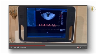 تجربه شیرین برای مادران