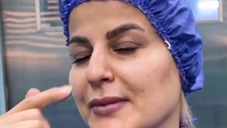 زیباجوی عزیزمون سارا خانوم که از بندرعباس تشریف اورده بودن و بینی گوشتی داشتن و …