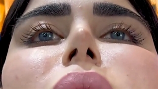 زیباجوی عزیزمون مریم خانوم بعلت #پروجکشنبینی و عدم تقارن پره های بینی جهت ترمیم مراجعه کرده بود