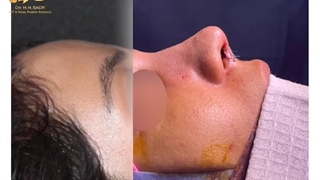 جراحی بینی مراجعهکننده ی عزیز