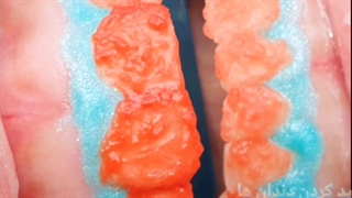 سفید کردن یا بلیچینگ دندان | دکتر مهدی کچوئی و دکتر راضیه کامران