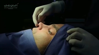 باهم نتیجه یک جراحی بینی مردانه ببینیم ؟ ☝