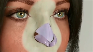 آیا حساسیت و آلــــــ