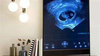 باورتون میشه ؟ ‌ بعد از هفـــــــ17ـــده سال انتظار ...