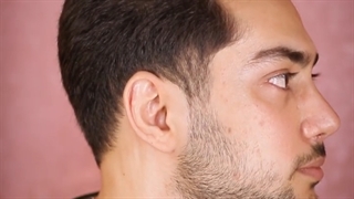 یه حس از جراحی زیبایی رینوپلاستی