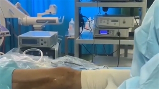 خشکی و محدودیت شدید حرکت زانو