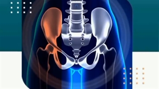 جراحی آرتروپلاستی لگن
