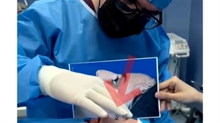 جراحی زیبایی بینی