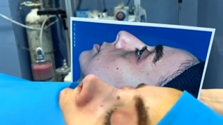 فیلم جراحی زیبایی بینی