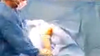 لایو جراحی تعویض مفصل زانو