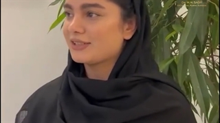 عمل بینی گوشتی بعد از ۶ ماه