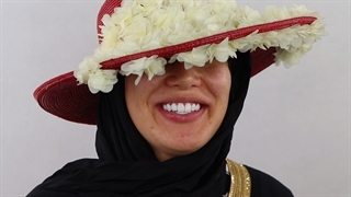 جادوی ونیر کامپوزیت در لبخندی جذاب