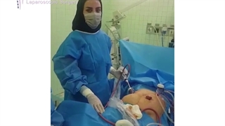عمل لاپاروسکوپی بستن کولستومی