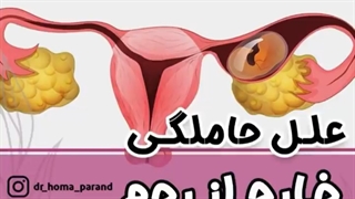 چرا حاملگی خارج از رحم اتفاق میافته؟