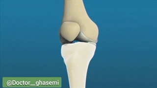 تعویض مفصل زانو