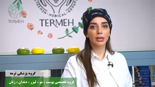 علل ریزش مو