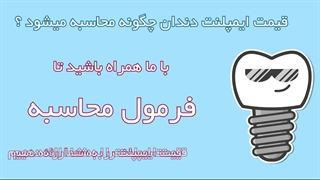 قیمت ایمپلنت دندان چگونه محاسبه می شود ؟