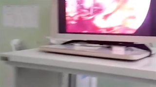 جراحی فتق ۲۰ سانت جدار شکم در محل عمل قبلی برداشتن قسمتی از روده بزرگ✅✅