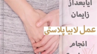 آیا می توان عمل لابیاپلاستی را بلافاصله بعد از زایمان طبیعی انجام داد⁉️