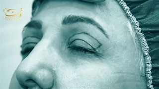 چشم هایی زیبا داشته باش با یه جراحی ساده