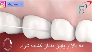 روش استفاده از نخ دندان
