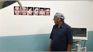 جراحی رینوپلاستی