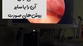 جراحی اندوسکوپیک