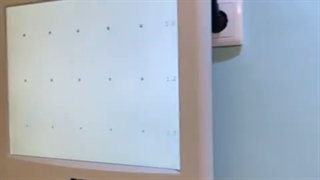 نتیجه ی مطلوب بعد از عمل لازک