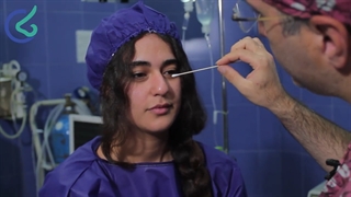 جراحی واقعی بینی