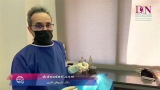 جراحی افتادگی پلک برای مراجعه کننده آقا