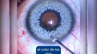 عمل تغییر رنگچشم توصیه می شود یا خیر؟