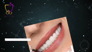 اصلاح طرح لبخند