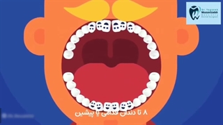 دندان کودکتونو چکاپ کردید ؟