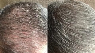 پرپشت کننده موهای جو گندمی لوییس بین