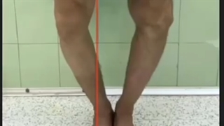 زانوى پرانتزى