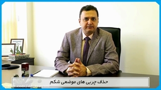 حذف چربی موضعی شکم و لیفت شکم