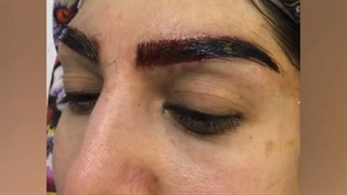 کاشت ابرو با کاور کامل تتو کاشت مو