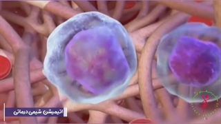 کسی رو میشناسید شیمی درمانی کرده باشه؟