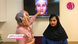 نمونه جراحی رینوپلاستی